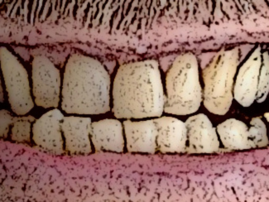 40 Zähne ( und das Shimano Mysterium )